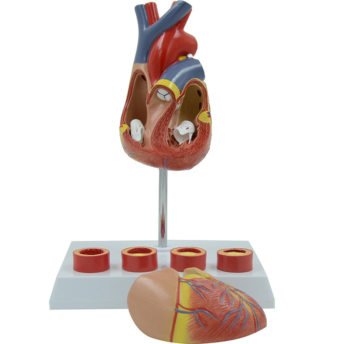 Heart with Arteriosclerosis Model