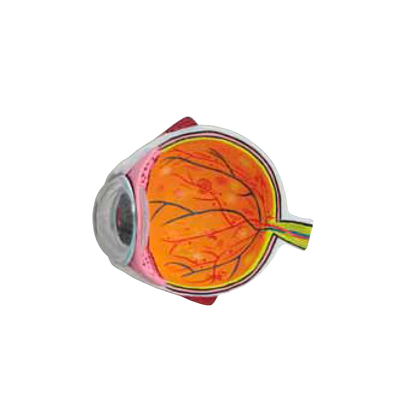 Load image into Gallery viewer, Effects of Type II Diabetes Model
