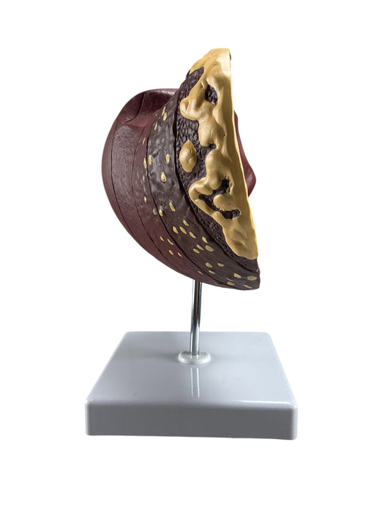 Liver Section with Pathology Model