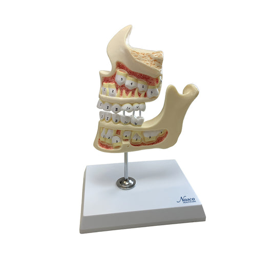 Desarrollo del Conjunto de Modelos de Dentición, 4 Etapas [SKU: MG36200]