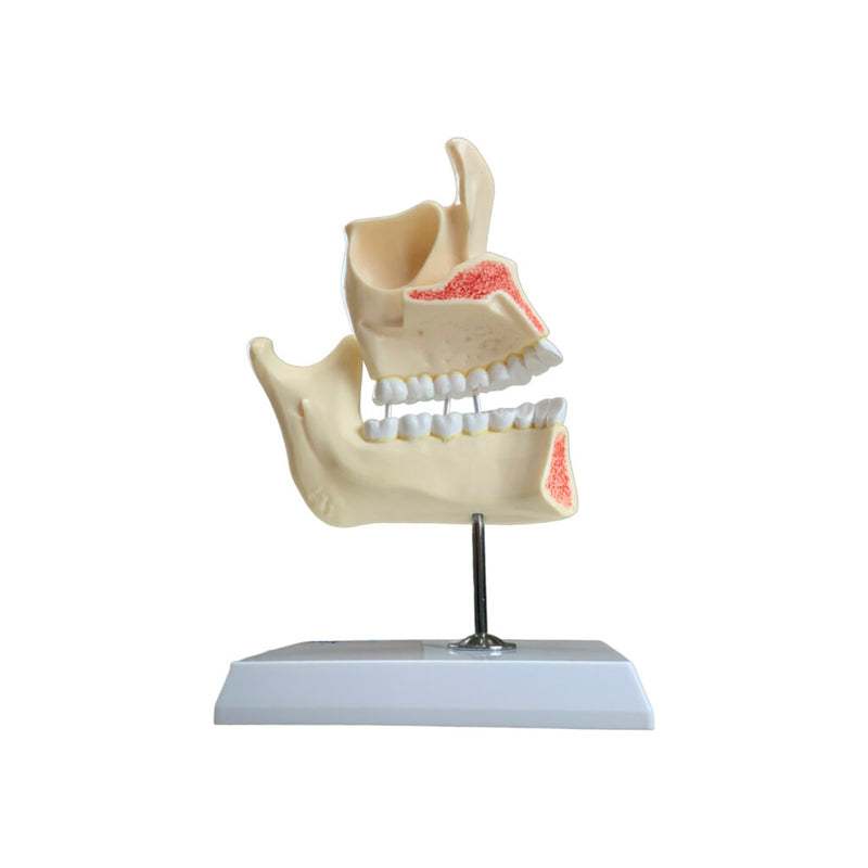 Load image into Gallery viewer, Development of Dentition Models Set, 4 Stages
