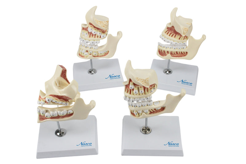 Load image into Gallery viewer, Development of Dentition Models Set, 4 Stages
