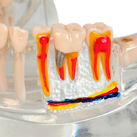 Mô Hình Răng Miệng Người Lớn Trong Suốt Bình Thường và Bệnh Lý [SKU: MG38398]