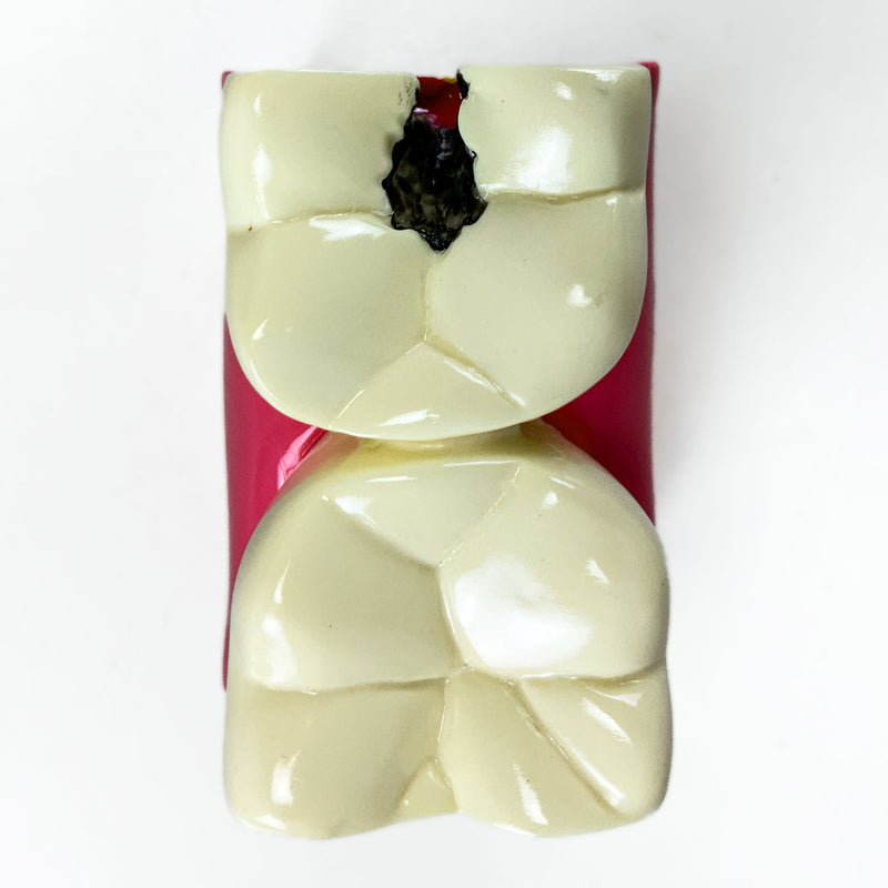 Cargue la imagen en el visor de la galería, Modelo de Enfermedad Dental, 6X Ampliado [SKU: MG39442]
