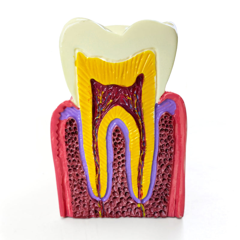 Cargue la imagen en el visor de la galería, Modelo de Enfermedad Dental, 6X Ampliado [SKU: MG39442]
