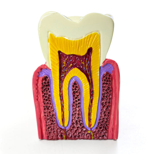 Modelo de Enfermedad Dental, 6X Ampliado [SKU: MG39442]