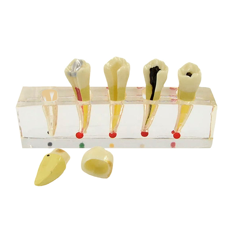 Afbeelding laden in Galerijviewer, Endodontische Tandheelkundige Model, 5 Onderdelen [SKU: MG39443]
