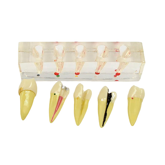 Endodontische Tandheelkundige Model, 5 Onderdelen [SKU: MG39443]