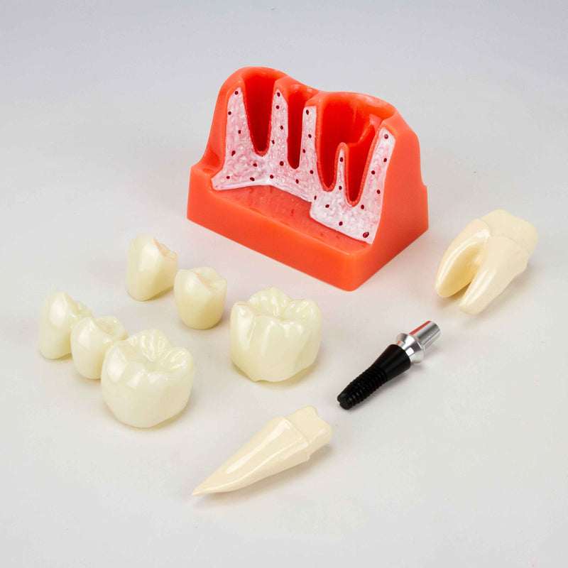 Cargue la imagen en el visor de la galería, Modelo de Implante Dental, 8 Piezas [SKU: MG39444]
