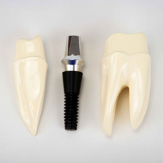Modelo de Implante Dental, 8 Piezas [SKU: MG39444]