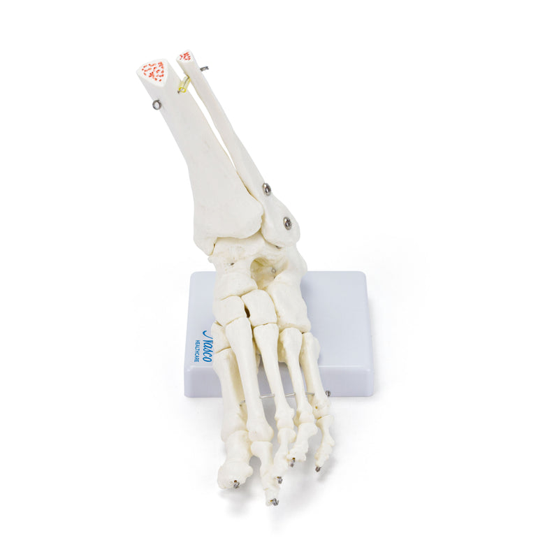 โหลดรูปภาพลงในโปรแกรมใช้ดูของ Gallery Skeletal Foot on Base
