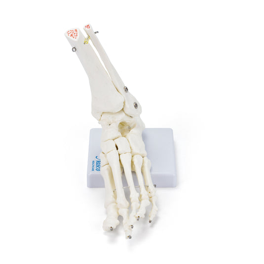 Skeletal Foot on Base