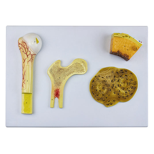 Bone Model, 4 Parts [SKU: MG23172] – Nasco Healthcare