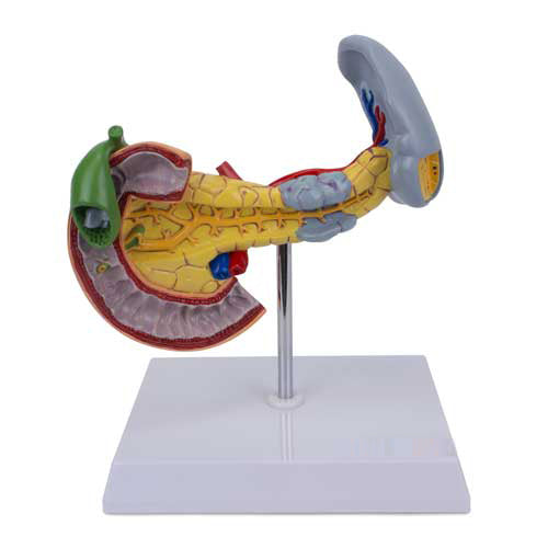 Modello di Pancreas, Milza e Cistifellea con Patologie [SKU: MG14742]