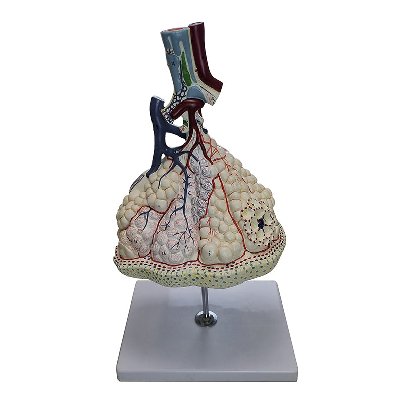 Cargue la imagen en el visor de la galería, Modelo de lóbulos pulmonares con vasos sanguíneos [SKU: MG13129]
