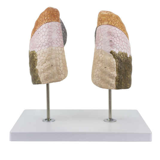 Segmented Lung Model [SKU: MG30886]