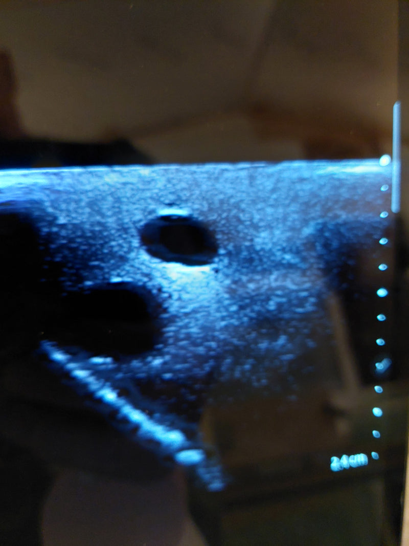 Load image into Gallery viewer, SonoEZ Pediatric Ultrasound Trainer - CVC
