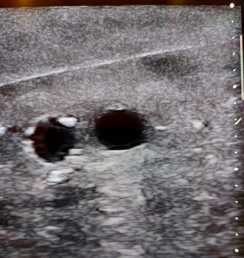 Load image into Gallery viewer, SonoEZ Pediatric Ultrasound Trainer - Vessel
