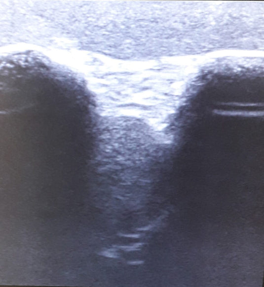 SonoEZ Ultrasound Trainer - Shoulder Exercise