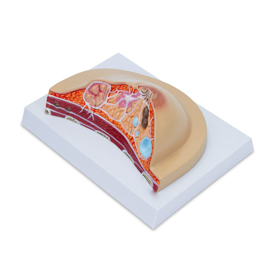 Breast Cross-Section with Pathologies Model [SKU: MG17229]