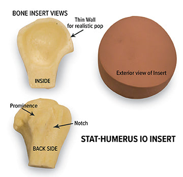 STAT Humerus intraossärer (IO) Einsatz