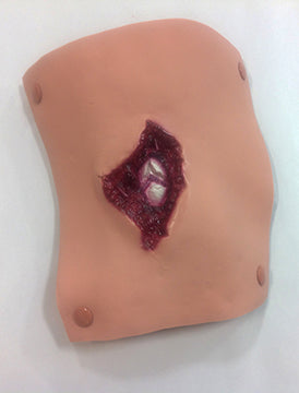 Załaduj obraz do przeglądarki galerii, Złamanie otwarte kości ramiennej
