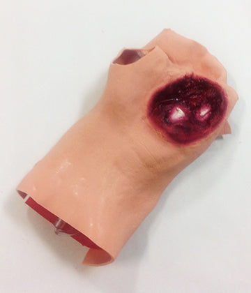 Gunshot Wound Palm