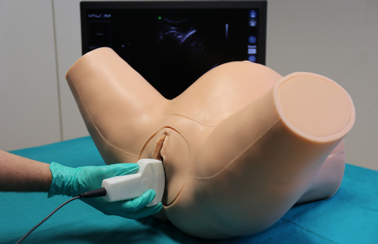 SIÊU ÂM THEO DÕI TRỨNG RỤNG HỖ TRỢ DỰ ĐOÁN THỜI ĐIỂM RỤNG TRỨNG CHÍNH XÁC