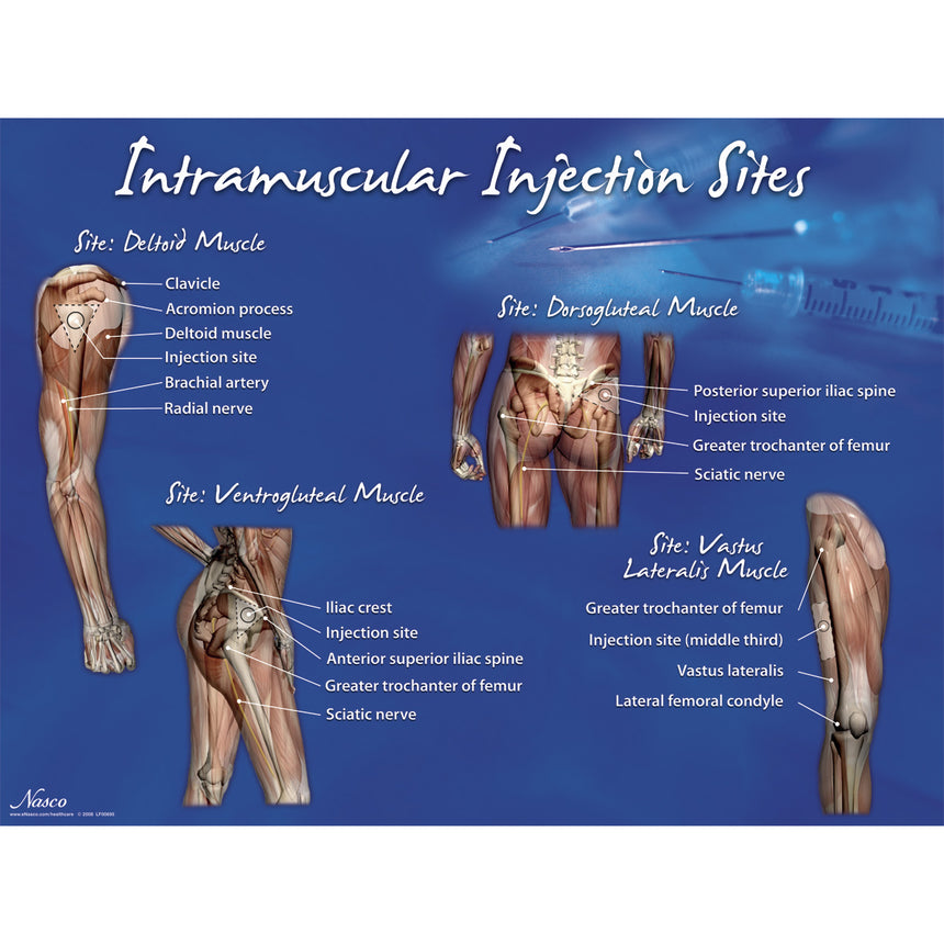 Intramuscular Injection Sites Poster
