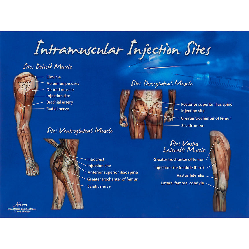 Nasco Posterior Heart & Lung Sites Poster