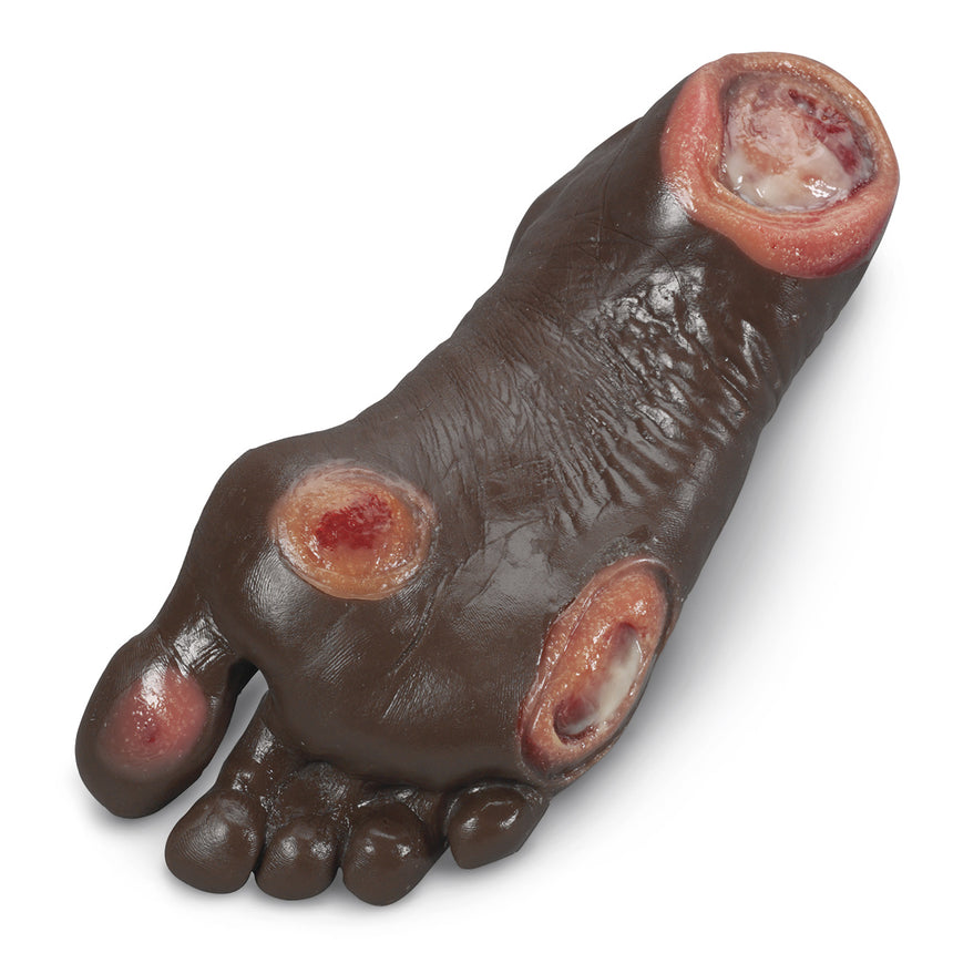 Life/form® Elderly Pressure Ulcer Foot - Dark [SKU: LF00944]