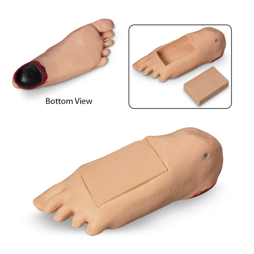 Life/form®  GERi  and  KERi  Optional Edema Foot with Deep Tissue Injury - Light