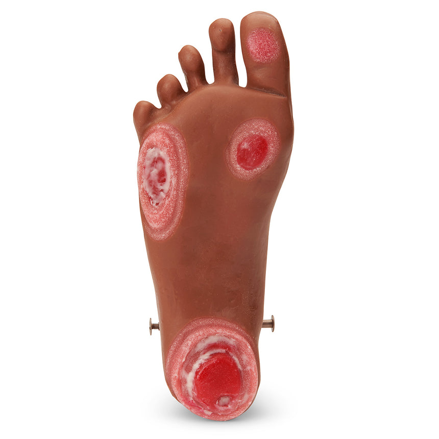 Life/form®  GERi / KERi  Optional Pressure Injury Foot - Medium  [SKU: LF04128]