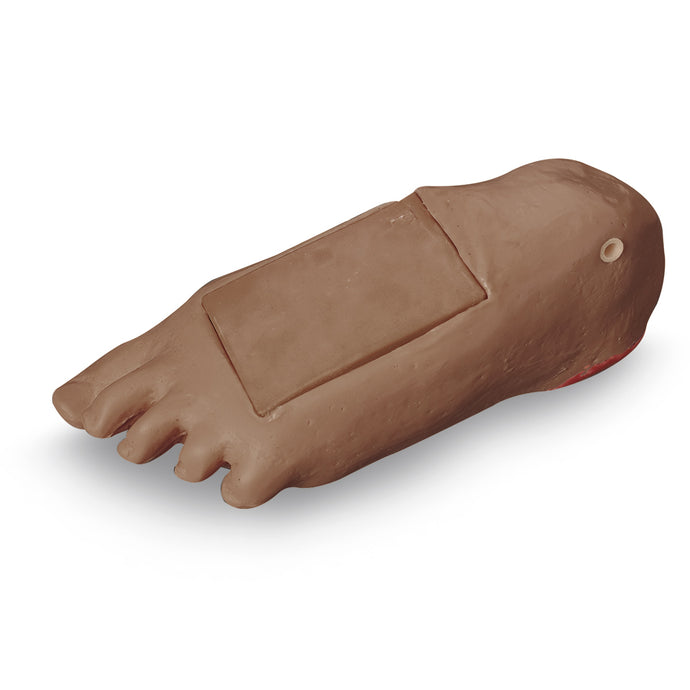 Life/form®  GERi / KERi  Optional Edema Foot with Deep Tissue Injury - Medium