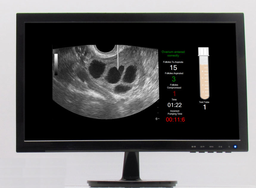 SonoHysteroSim LCD Monitor [SKU: SHSMON]