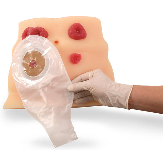 Ostomy Care Model [SKU: SB23501]