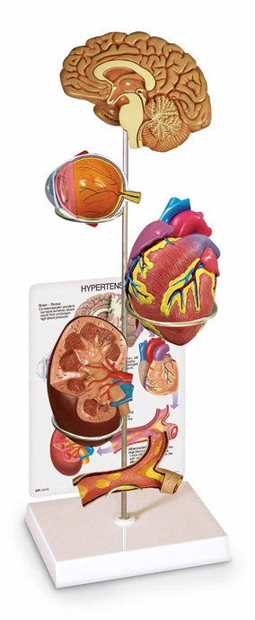 Набор моделей гипертонии [SKU: SB40233]