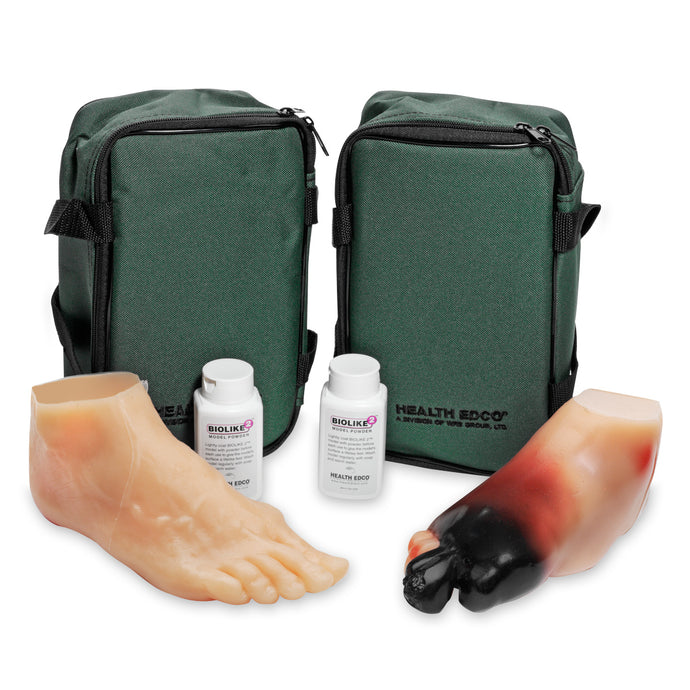 Diabetic Foot Model Set