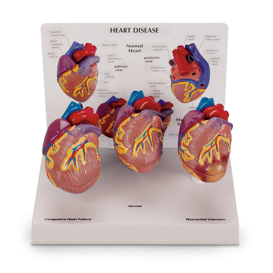 Juego Mini Corazón 3 Piezas Modelos [SKU: SB44893]