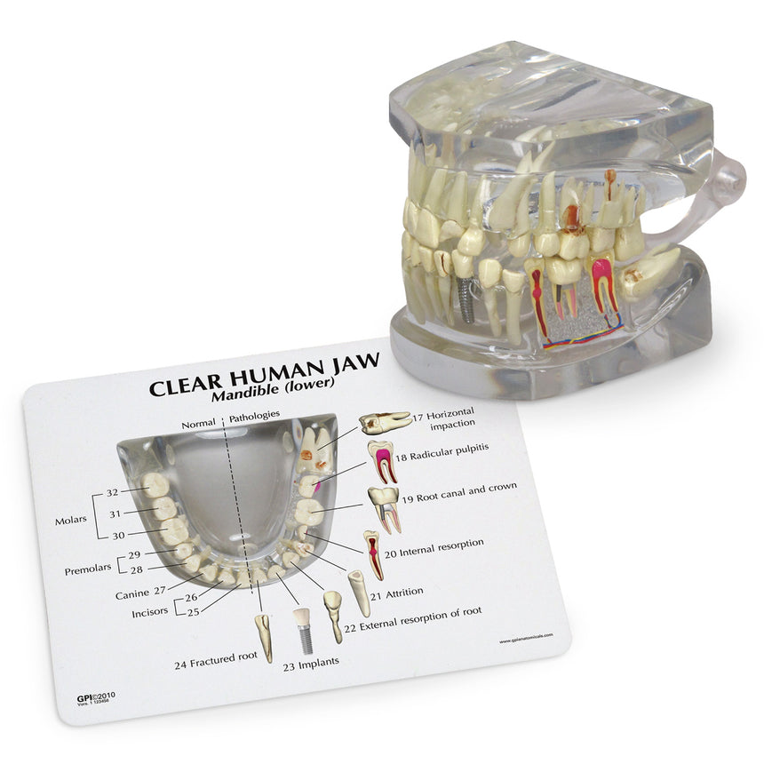 Mandíbula humana clara con dientes