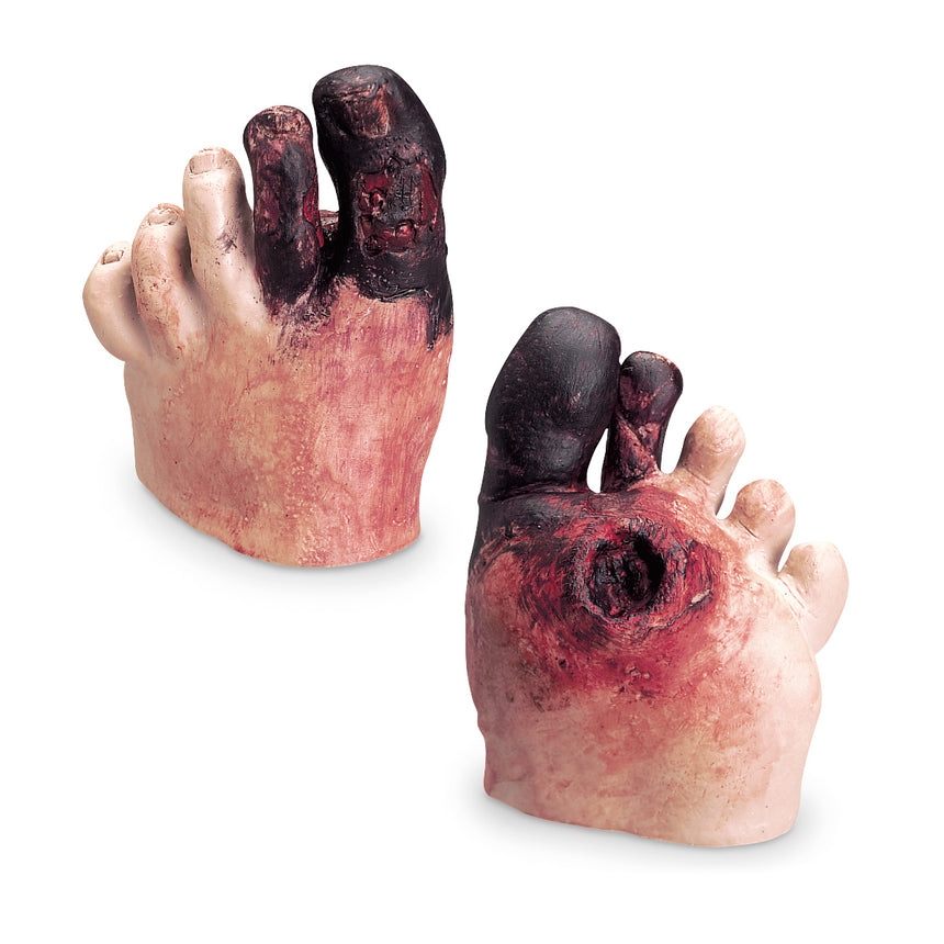 Life/form® Unhealthy Foot Care Kit [SKU: WA21216]