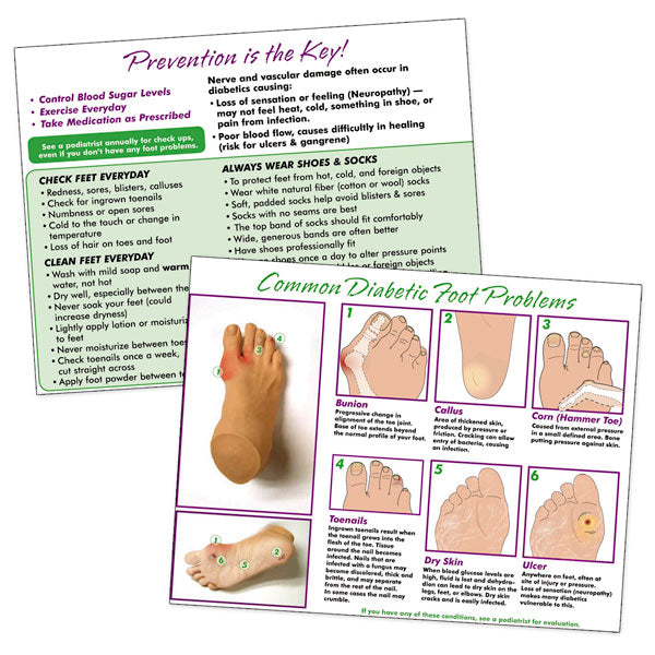 Intramuscular Injection Sites Poster