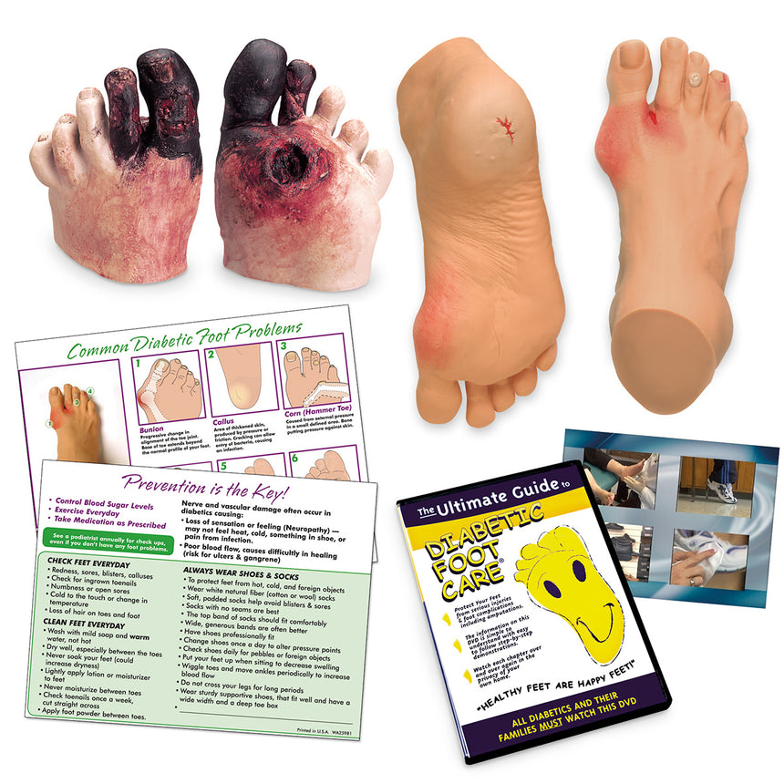 Life/form® Complete Diabetic Foot Care Education [SKU: WA29842]