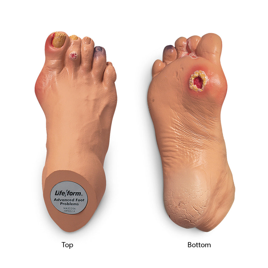 Venipuncture Training Aid - Four-Vein Model [SKU: SB23527]