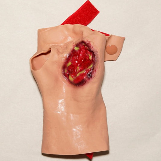 Basic Electrical Burn to Hand